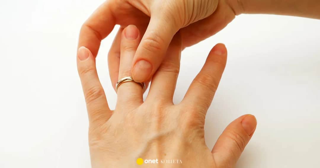 Jak zdjąć obrączkę z palca? Domowe triki i pomoc ekspertów.